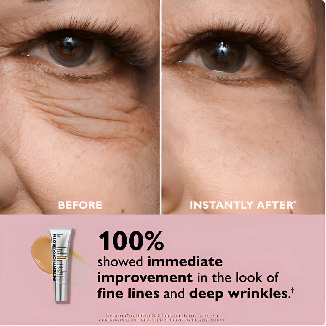 INSTANT ACTION: SMOOTHS LINES, REDUCES PUFFINESS & DARK CIRCLES